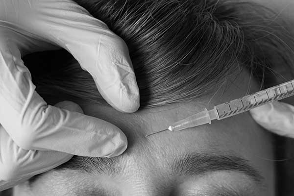 Inyección de botox, tratamientos antiarrugas seguros en clínica estética Dr.Sebastián Bonancic