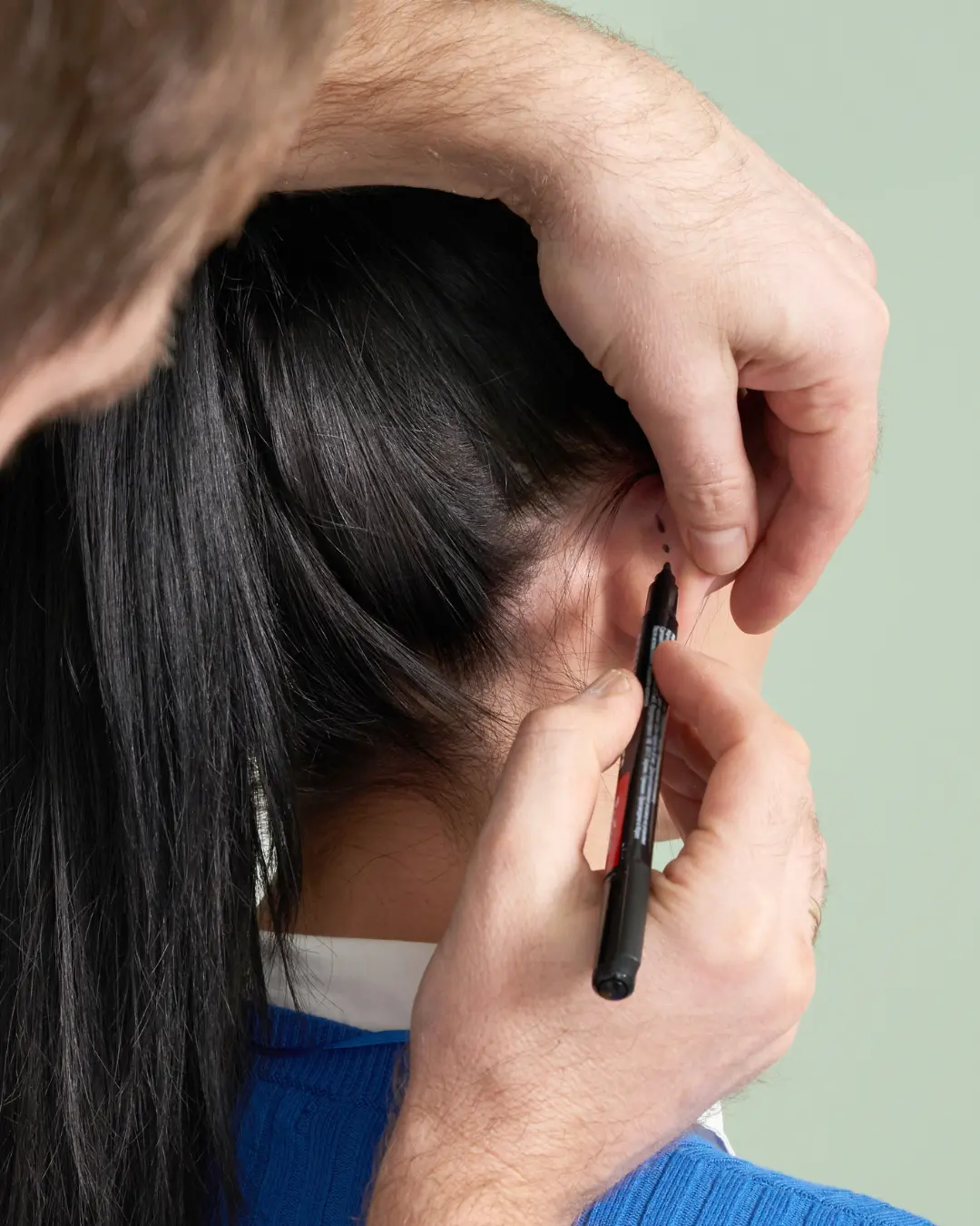 Otoplastia cirugía estética oído.